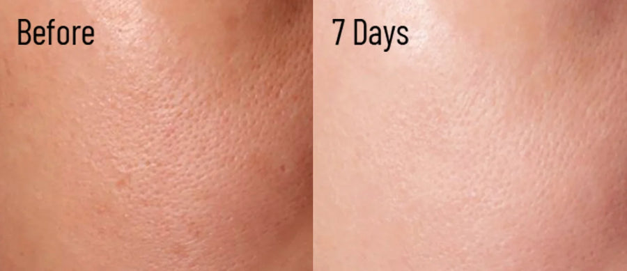 Skin comparison