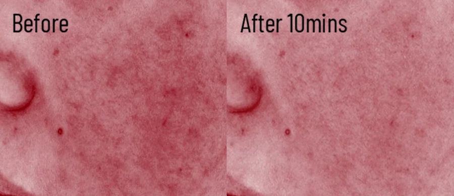 Skin comparison