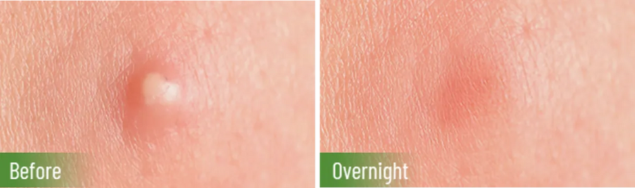*The data is based on evaluations from 33 subjects after 7 consecutive days of using this product. 
Actual results may vary.