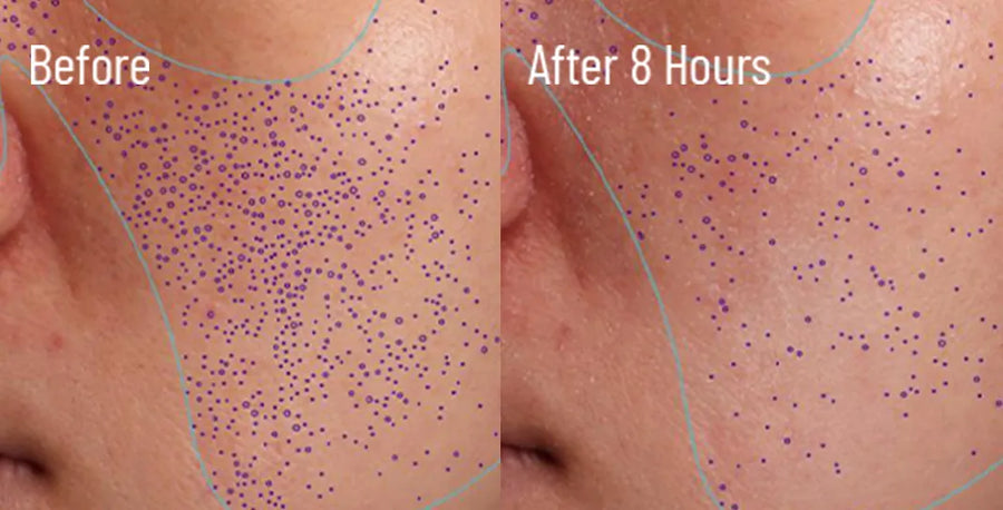 Skin comparison