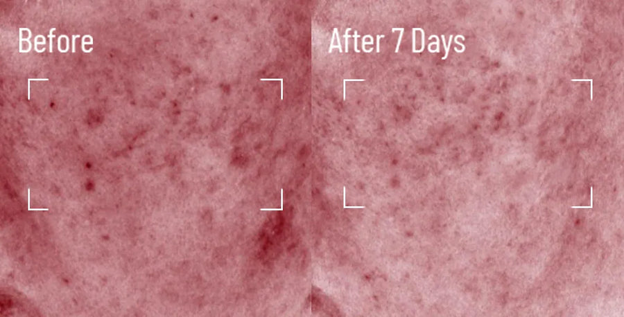 Skin comparison