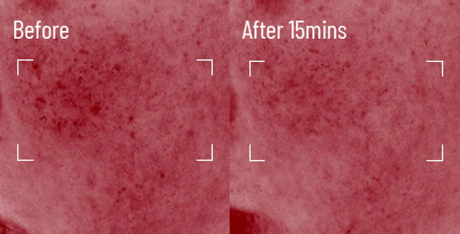 Skin comparison