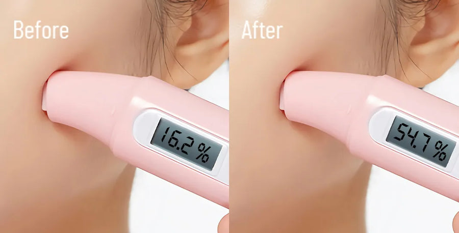 Skin comparison