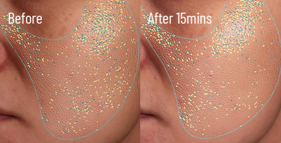 Skin comparison